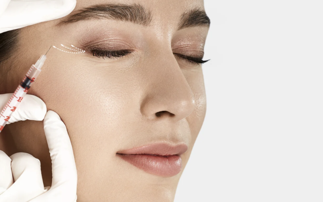 Safe Botox Appointment Options for Crow’s Feet Near Olney MD